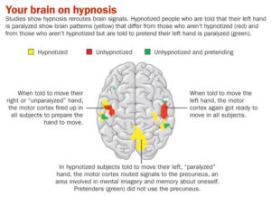 hypnose brein